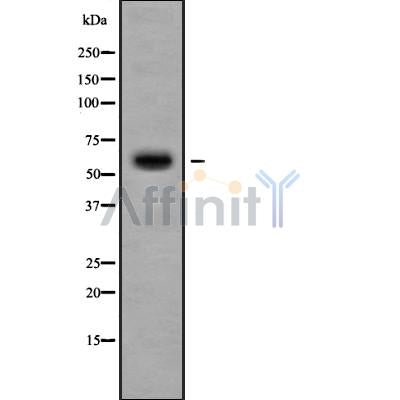 DF10091 at 1/100 staining Mouse kidney tissue by IHC-P. The sample was formaldehyde fixed and a heat mediated antigen retrieval step in citrate buffer was performed. The sample was then blocked and incubated with the antibody for 1.5 hours at 22¡ãC. An HRP conjugated goat anti-rabbit antibody was used as the secondary