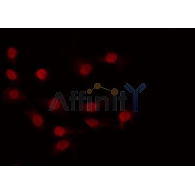 Western blot analysis of extracts from mouse brain, using CDK11 Antibody.