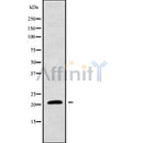 Western blot analysis of extracts from mouse brain, using CYBA Antibody.