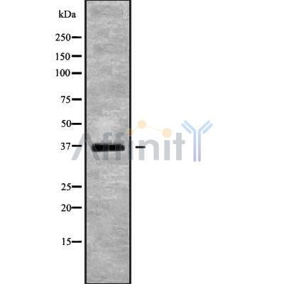 Western blot analysis of DNAJB2 using HUVEC whole cell lysates