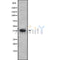 Western blot analysis of extracts from 293, using IL20L2 Antibody. The lane on the left was treated with blocking peptide.