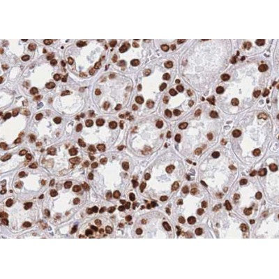 AF0792 staining Hela by IF/ICC. The sample were fixed with PFA and permeabilized in 0.1% Triton X-100,then blocked in 10% serum for 45 minutes at 25¡ãC. The primary antibody was diluted at 1/200 and incubated with the sample for 1 hour at 37¡ãC. An  Alexa Fluor 594 conjugated goat anti-rabbit IgG (H+L) Ab, diluted at 1/600, was used as the secondary antibod