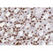 AF0792 staining Hela by IF/ICC. The sample were fixed with PFA and permeabilized in 0.1% Triton X-100,then blocked in 10% serum for 45 minutes at 25¡ãC. The primary antibody was diluted at 1/200 and incubated with the sample for 1 hour at 37¡ãC. An  Alexa Fluor 594 conjugated goat anti-rabbit IgG (H+L) Ab, diluted at 1/600, was used as the secondary antibod