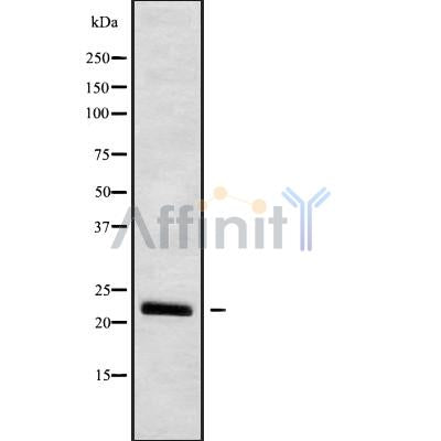 Western blot analysis IFNW1 using HUVEC whole cell lysates