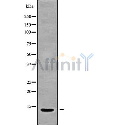 Western blot analysis of extracts from rat kidney and mouse spleen, using IGFL2 Antibody.