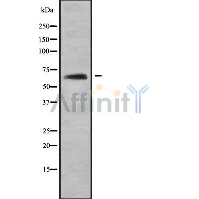 Western blot analysis of KRT84 using HeLa whole cell lysates