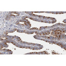 AF0665 staining HepG2 by IF/ICC. The sample were fixed with PFA and permeabilized in 0.1% Triton X-100,then blocked in 10% serum for 45 minutes at 25¡ãC. The primary antibody was diluted at 1/200 and incubated with the sample for 1 hour at 37¡ãC. An  Alexa Fluor 594 conjugated goat anti-rabbit IgG (H+L) Ab, diluted at 1/600, was used as the secondary antibod