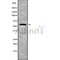 DF10121 at 1/100 staining Human kidney tissue by IHC-P. The sample was formaldehyde fixed and a heat mediated antigen retrieval step in citrate buffer was performed. The sample was then blocked and incubated with the antibody for 1.5 hours at 22¡ãC. An HRP conjugated goat anti-rabbit antibody was used as the secondary
