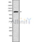 Western blot analysis of MCM8 using COLO205 whole cell lysates