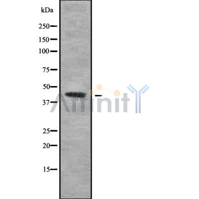 Western blot analysis of KLF17 using HeLa whole cell lysates