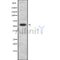 Western blot analysis of extracts from K562, using SMARCD1/3 Antibody. The lane on the left was treated with blocking peptide.