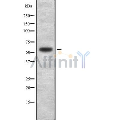 Western blot analysis of extracts from K562, using SMARCD1/3 Antibody. The lane on the left was treated with blocking peptide.