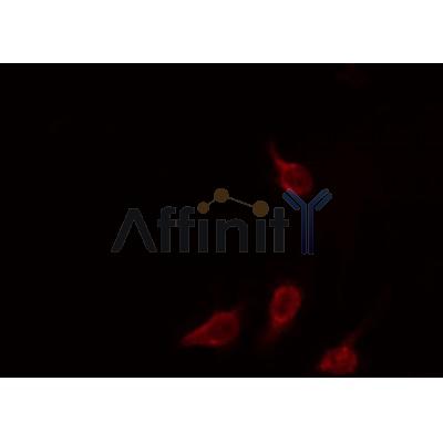 AF0640 staining Hela by IF/ICC. The sample were fixed with PFA and permeabilized in 0.1% Triton X-100,then blocked in 10% serum for 45 minutes at 25¡ãC. The primary antibody was diluted at 1/200 and incubated with the sample for 1 hour at 37¡ãC. An  Alexa Fluor 594 conjugated goat anti-rabbit IgG (H+L) Ab, diluted at 1/600, was used as the secondary antibod