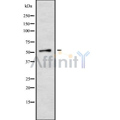 Western blot analysis of Cytochrome P450 2A6/7/13 using COLO205 whole cell lysates