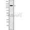 DF10131 at 1/100 staining Human prostate tissue by IHC-P. The sample was formaldehyde fixed and a heat mediated antigen retrieval step in citrate buffer was performed. The sample was then blocked and incubated with the antibody for 1.5 hours at 22¡ãC. An HRP conjugated goat anti-rabbit antibody was used as the secondary