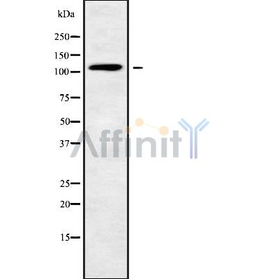 Western blot analysis NPR2 using COLO205 whole cell lysates