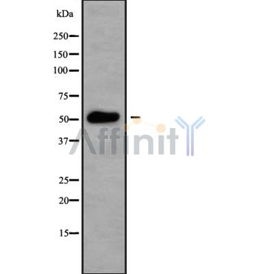 DF10135 at 1/100 staining Human lung tissue by IHC-P. The sample was formaldehyde fixed and a heat mediated antigen retrieval step in citrate buffer was performed. The sample was then blocked and incubated with the antibody for 1.5 hours at 22¡ãC. An HRP conjugated goat anti-rabbit antibody was used as the secondary