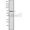DF10136 at 1/100 staining Human gastric tissue by IHC-P. The sample was formaldehyde fixed and a heat mediated antigen retrieval step in citrate buffer was performed. The sample was then blocked and incubated with the antibody for 1.5 hours at 22¡ãC. An HRP conjugated goat anti-rabbit antibody was used as the secondary