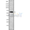 Western blot analysis of extracts from various samples, using TXK Antibody.
 Lane 1: Mouse  brain, treated with blocking peptide;
 Lane 2: Mouse  brain;
 Lane 3: HepG2.

Observed bands: 70 kDa.