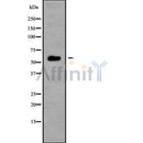 DF10146 staining  HepG2 cells by IF/ICC. The sample were fixed with PFA and permeabilized in 0.1% Triton X-100,then blocked in 10% serum for 45 minutes at 25¡ãC. The primary antibody was diluted at 1/200 and incubated with the sample for 1 hour at 37¡ãC. An  Alexa Fluor 594 conjugated goat anti-rabbit IgG (H+L) antibody(Cat.