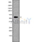 DF10146 staining  HepG2 cells by IF/ICC. The sample were fixed with PFA and permeabilized in 0.1% Triton X-100,then blocked in 10% serum for 45 minutes at 25¡ãC. The primary antibody was diluted at 1/200 and incubated with the sample for 1 hour at 37¡ãC. An  Alexa Fluor 594 conjugated goat anti-rabbit IgG (H+L) antibody(Cat.