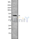 DF10152 at 1/100 staining Human gastric tissue by IHC-P. The sample was formaldehyde fixed and a heat mediated antigen retrieval step in citrate buffer was performed. The sample was then blocked and incubated with the antibody for 1.5 hours at 22¡ãC. An HRP conjugated goat anti-rabbit antibody was used as the secondary