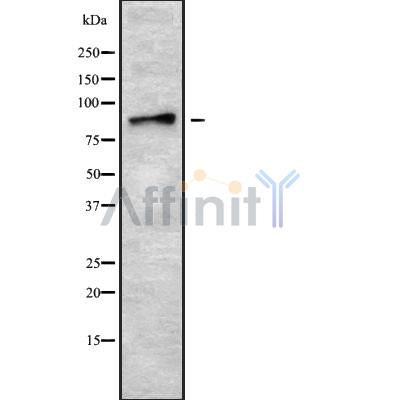 DF10153 at 1/100 staining Rat colon tissue by IHC-P. The sample was formaldehyde fixed and a heat mediated antigen retrieval step in citrate buffer was performed. The sample was then blocked and incubated with the antibody for 1.5 hours at 22¡ãC. An HRP conjugated goat anti-rabbit antibody was used as the secondary