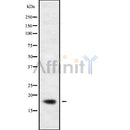 DF10154 at 1/100 staining Human Head and neck cancer tissue by IHC-P. The sample was formaldehyde fixed and a heat mediated antigen retrieval step in citrate buffer was performed. The sample was then blocked and incubated with the antibody for 1.5 hours at 22¡ãC. An HRP conjugated goat anti-rabbit antibody was used as the secondary