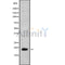 Western blot analysis of TNFRSF13C using HUVEC whole cell lysates