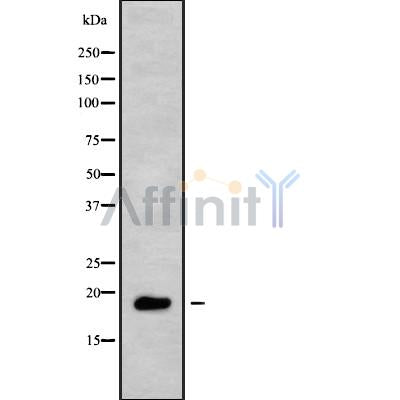 Western blot analysis of TNFRSF13C using HUVEC whole cell lysates