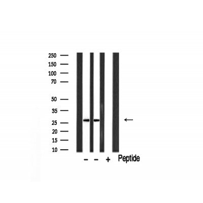Western blot analysis of extracts of various tissue sample,using Granzyme B Antibody .