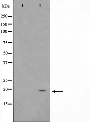 Western blot analysis on HepG2 cell lysate using Bax Antibody.The lane on the left is treated with the antigen-specific peptide.