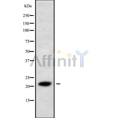 Western blot analysis IL28A using 293 whole cell lysates