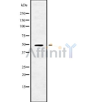 Western blot analysis of RGMB using COLO205 whole cell lysates
