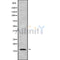 Western blot analysis of HBQ1 using HUVEC whole cell lysates
