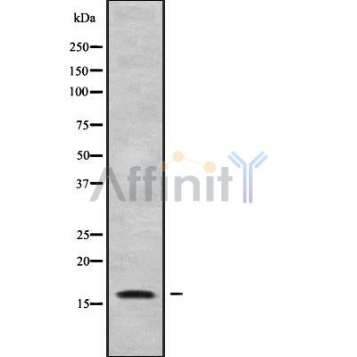 Western blot analysis of HBQ1 using HUVEC whole cell lysates