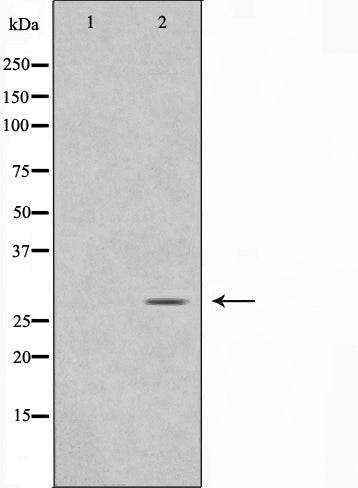 Western blot analysis on rat brain cell lysate using MOBL3 Antibody,The lane on the left is treated with the antigen-specific peptide.