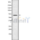 DF10171 staining Hela by IF/ICC. The sample were fixed with PFA and permeabilized in 0.1% Triton X-100,then blocked in 10% serum for 45 minutes at 25¡ãC. The primary antibody was diluted at 1/200 and incubated with the sample for 1 hour at 37¡ãC. An  Alexa Fluor 594 conjugated goat anti-rabbit IgG (H+L) Ab, diluted at 1/600, was used as the secondary antibod