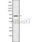 DF10171 staining Hela by IF/ICC. The sample were fixed with PFA and permeabilized in 0.1% Triton X-100,then blocked in 10% serum for 45 minutes at 25¡ãC. The primary antibody was diluted at 1/200 and incubated with the sample for 1 hour at 37¡ãC. An  Alexa Fluor 594 conjugated goat anti-rabbit IgG (H+L) Ab, diluted at 1/600, was used as the secondary antibod