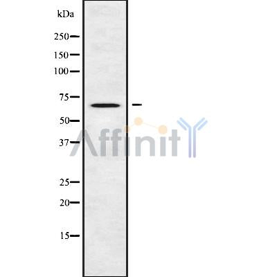 DF10171 staining Hela by IF/ICC. The sample were fixed with PFA and permeabilized in 0.1% Triton X-100,then blocked in 10% serum for 45 minutes at 25¡ãC. The primary antibody was diluted at 1/200 and incubated with the sample for 1 hour at 37¡ãC. An  Alexa Fluor 594 conjugated goat anti-rabbit IgG (H+L) Ab, diluted at 1/600, was used as the secondary antibod