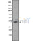 Western blot analysis SFRP1 using HUVEC whole cell lysates