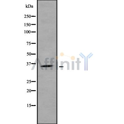 Western blot analysis SFRP1 using HUVEC whole cell lysates