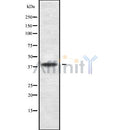 DF10175 staining Hela cells by IF/ICC. The sample were fixed with PFA and permeabilized in 0.1% Triton X-100,then blocked in 10% serum for 45 minutes at 25¡ãC. The primary antibody was diluted at 1/200 and incubated with the sample for 1 hour at 37¡ãC. An  Alexa Fluor 594 conjugated goat anti-rabbit IgG (H+L) antibody(Cat.