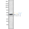 DF10175 staining Hela cells by IF/ICC. The sample were fixed with PFA and permeabilized in 0.1% Triton X-100,then blocked in 10% serum for 45 minutes at 25¡ãC. The primary antibody was diluted at 1/200 and incubated with the sample for 1 hour at 37¡ãC. An  Alexa Fluor 594 conjugated goat anti-rabbit IgG (H+L) antibody(Cat.