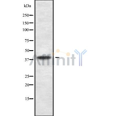 DF10175 staining Hela cells by IF/ICC. The sample were fixed with PFA and permeabilized in 0.1% Triton X-100,then blocked in 10% serum for 45 minutes at 25¡ãC. The primary antibody was diluted at 1/200 and incubated with the sample for 1 hour at 37¡ãC. An  Alexa Fluor 594 conjugated goat anti-rabbit IgG (H+L) antibody(Cat.