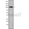 Western blot analysis SEMA6D using HUVEC whole cell lysates