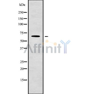 Western blot analysis of extracts from mouse liver,mouse lung, using LINGO2 Antibody.