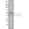 DF10179 at 1/100 staining Human Melanoma tissue by IHC-P. The sample was formaldehyde fixed and a heat mediated antigen retrieval step in citrate buffer was performed. The sample was then blocked and incubated with the antibody for 1.5 hours at 22¡ãC. An HRP conjugated goat anti-rabbit antibody was used as the secondary