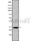 DF10182 staining Hela by IF/ICC. The sample were fixed with PFA and permeabilized in 0.1% Triton X-100,then blocked in 10% serum for 45 minutes at 25¡ãC. The primary antibody was diluted at 1/200 and incubated with the sample for 1 hour at 37¡ãC. An  Alexa Fluor 594 conjugated goat anti-rabbit IgG (H+L) Ab, diluted at 1/600, was used as the secondary antibod