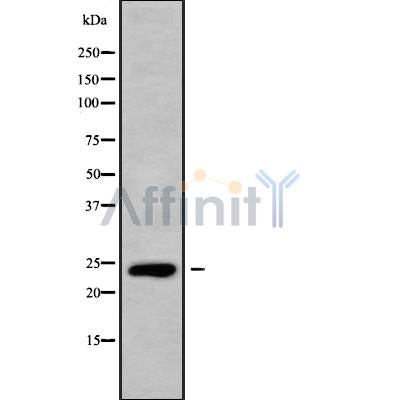 DF10182 staining Hela by IF/ICC. The sample were fixed with PFA and permeabilized in 0.1% Triton X-100,then blocked in 10% serum for 45 minutes at 25¡ãC. The primary antibody was diluted at 1/200 and incubated with the sample for 1 hour at 37¡ãC. An  Alexa Fluor 594 conjugated goat anti-rabbit IgG (H+L) Ab, diluted at 1/600, was used as the secondary antibod